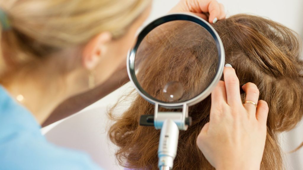 pidocchi dei capelli